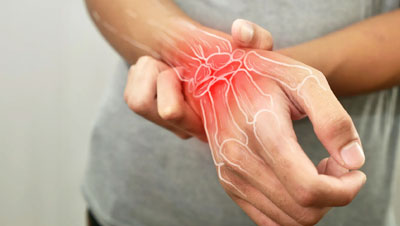 Arthritis Management & Joint Preservation